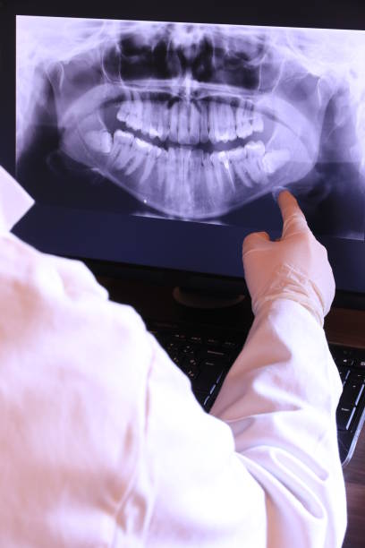 Best Emergency Root Canal Treatment in Parsons, TN