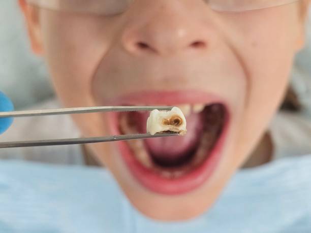 Best Orthodontic Emergency Dentist in Parsons, TN